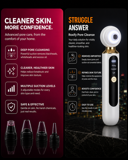 ROXIFY - Blackhead Remover Pore Vacuum
