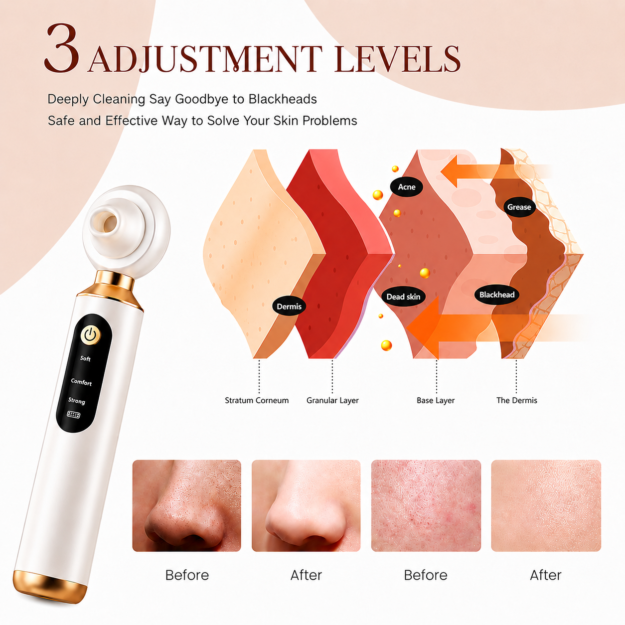 ROXIFY - Blackhead Remover Pore Vacuum