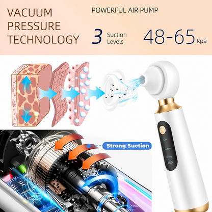 ROXIFY - Blackhead Remover Pore Vacuum