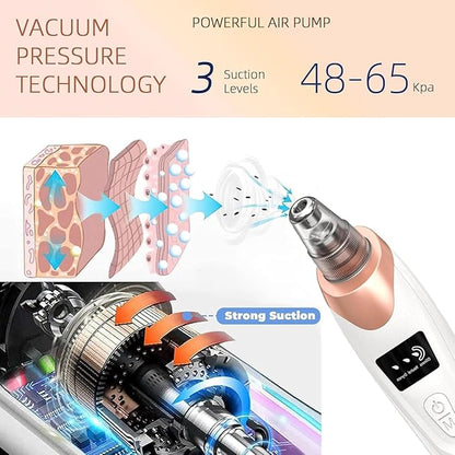ROXIFY - Blackhead Remover Pore Vacuum (second edition)